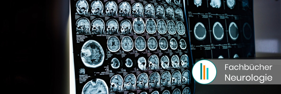 Fachbücher Neurologie Fachbücher Neurologie