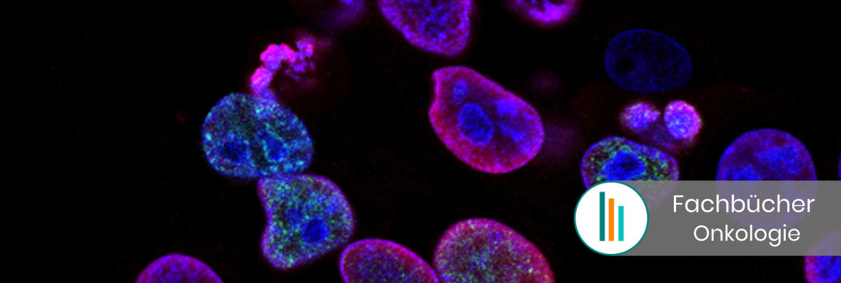 Fachbücher Onkologie